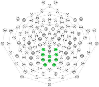 The P300 event related potential predicts phonological working memory skills in school-aged children